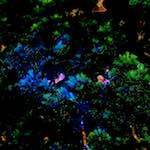 image: Image vum photoset <<damage (ccli)>>.