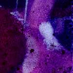 image: Image from the photoset &lsquo;damage (v)&rsquo;.