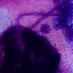 image: Image from the photoset &lsquo;damage (v)&rsquo;.