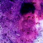 image: Image from the photoset &lsquo;damage (v)&rsquo;.