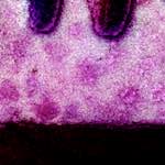 image: Image from the photoset &lsquo;damage (vii)&rsquo;.