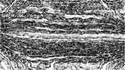 sketch effects 1 :: bwsoftedgesketcher2